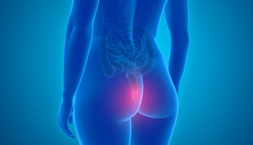 Remédios naturais para hemorroidas