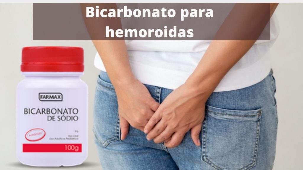 Bicarbonato de sódio é bom para hemorroidas?