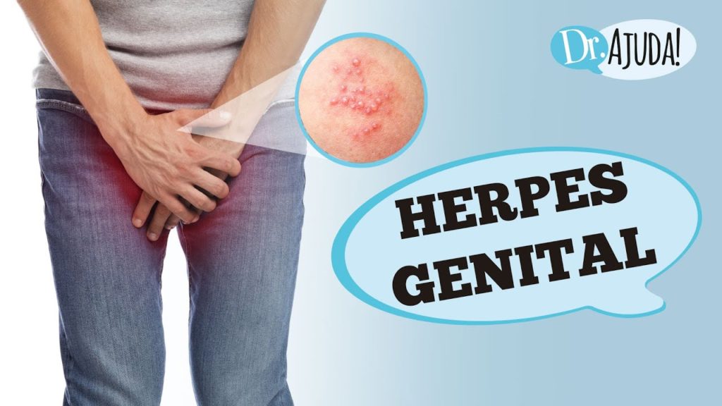 HERPES GENITAL: O que é?
