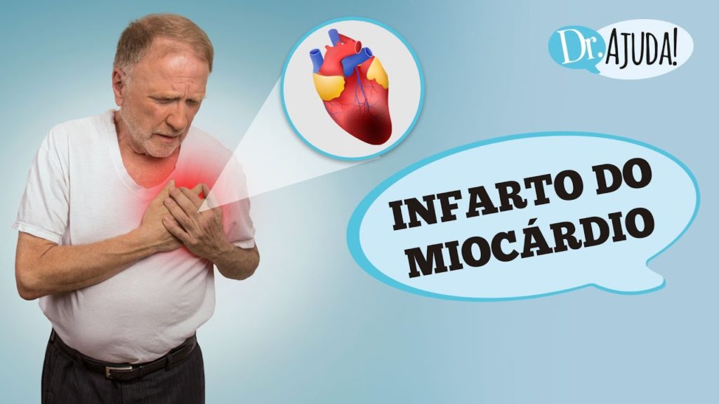 INFARTO DO MIOCÁRDIO