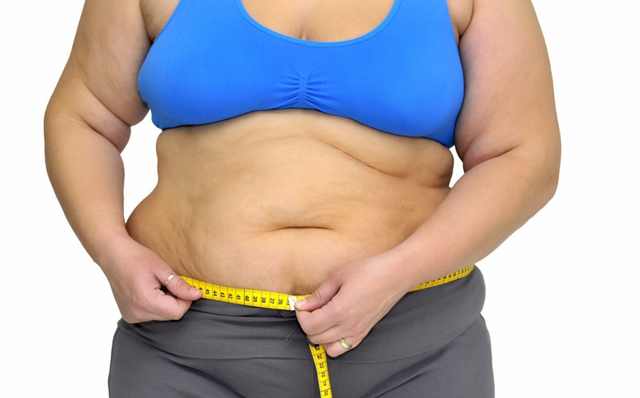 Como Queimar Gordura Localizada na Barriga
