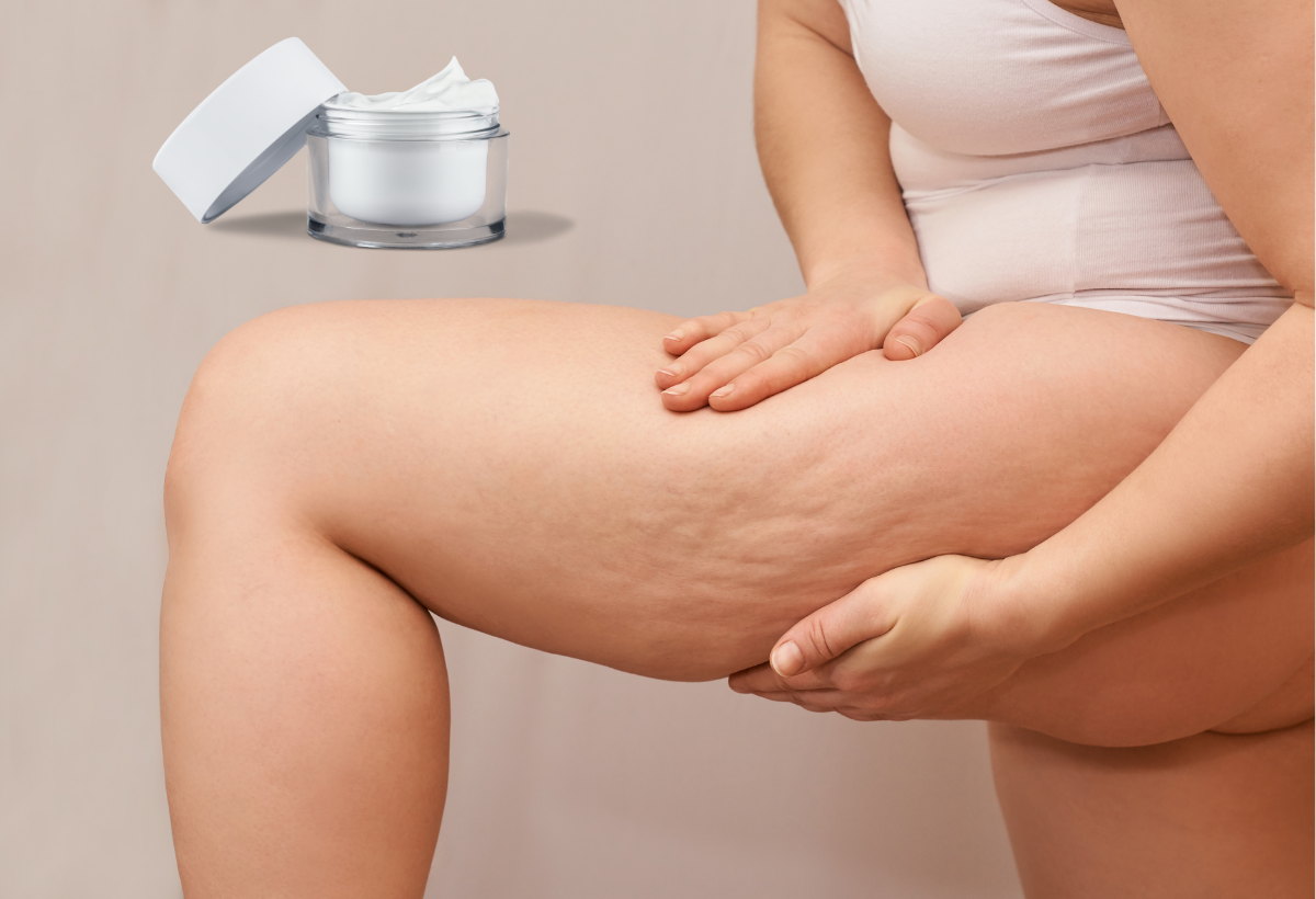 O que é o Lipedema?